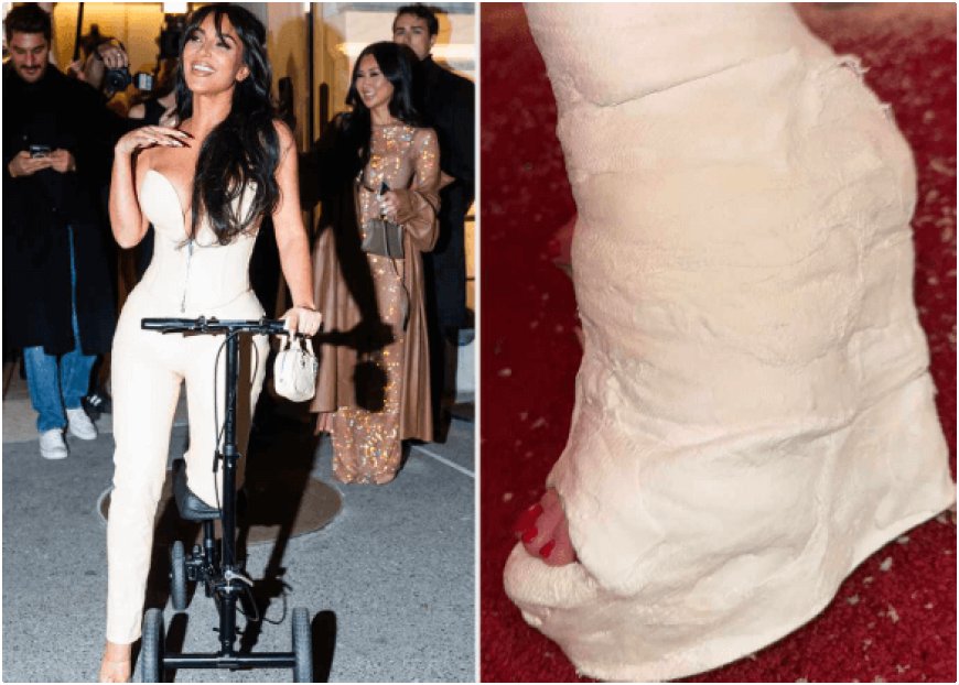 Kim Kardashian Transforms Broken Foot into Fashion Statement with Trendy Wedge Heel-Inspired Cast