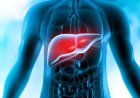 Surgeon Issues Serious Warning Over Common Diet Mistake Linked to Liver Disease